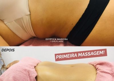 Serviço de Massagens - Estética Madeira